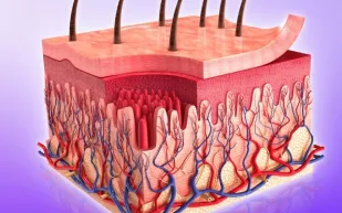 ما علاقة جين الشعر الأحمر ببطء التئام الجروح المزمنة؟.. دراسة تكشف