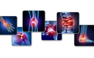 تقنية ثورية: ابتكار طبي جديد يعجّل التئام العظام دون جراحة إضافية