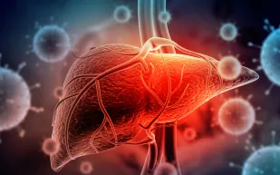 دراسة علمية: الدهون تؤثر على الكبد بطرق غير متوقعة