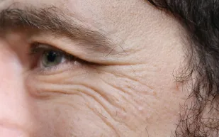 تجاعيد ما بعد الوسادة: أسرار حماية بشرتك من آثار النوم الخفية