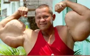  بعد وفاة لاعب كمال أجسام: تحذير عالمي من مخاطر الحقن لتضخيم العضلات