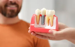 احذر.. تسوس  الأسنان قد يكون مؤشراً لمرض خطير