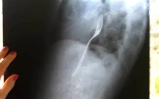 روماني يبلع شوكة ليفوز برهان مع صديقه