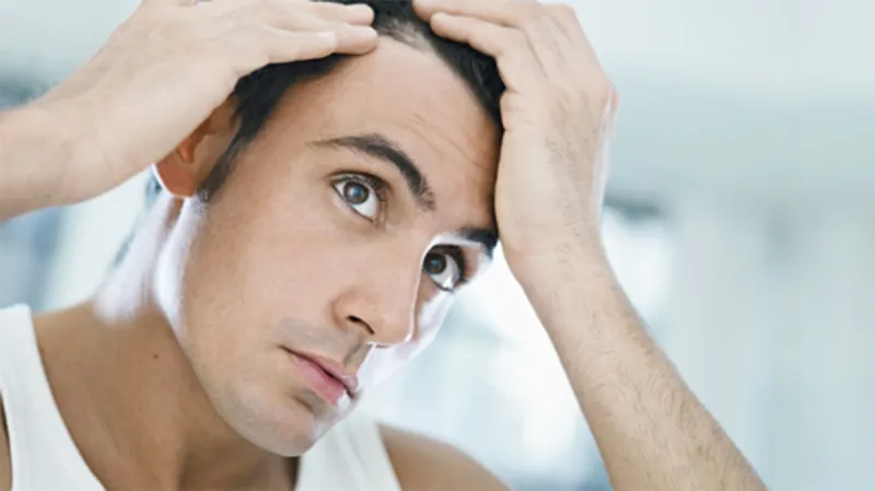 حلول لتفادي مشكلة الصلع