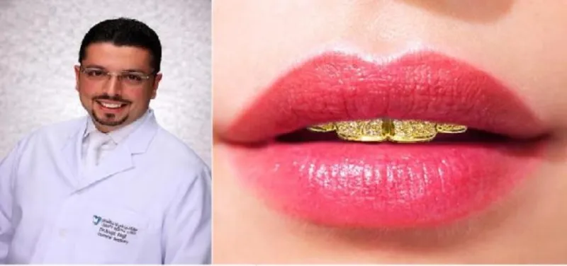 أغلى ابتسامة في العالم خليجية