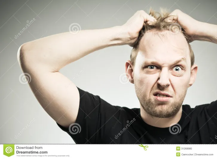 كيف تعرف إذا كنت ستصاب بالصلع أم لا؟