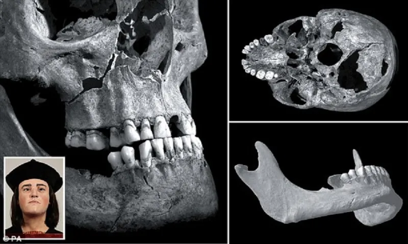 علماء بريطانين يكشفون الحقيقة الخفية وراء قتل الملك “ريتشارد الثالث”
