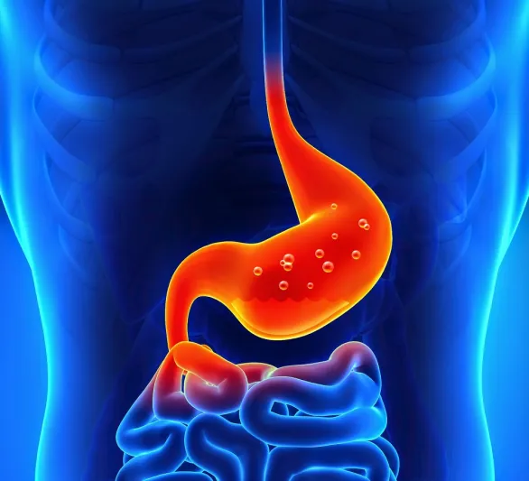حرقة المعدة..كيف تواجه مرض القرن ؟؟