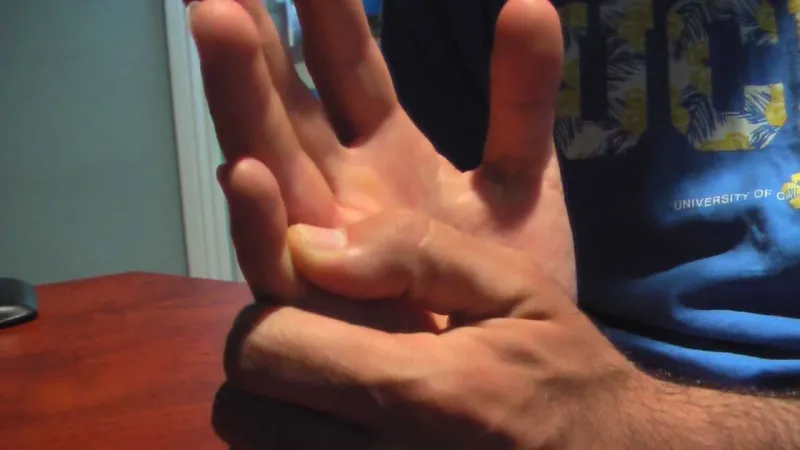 فيديو...سعودي يكسر إصبع صديقه ليأخذ إجازة في العيد من العسكرية