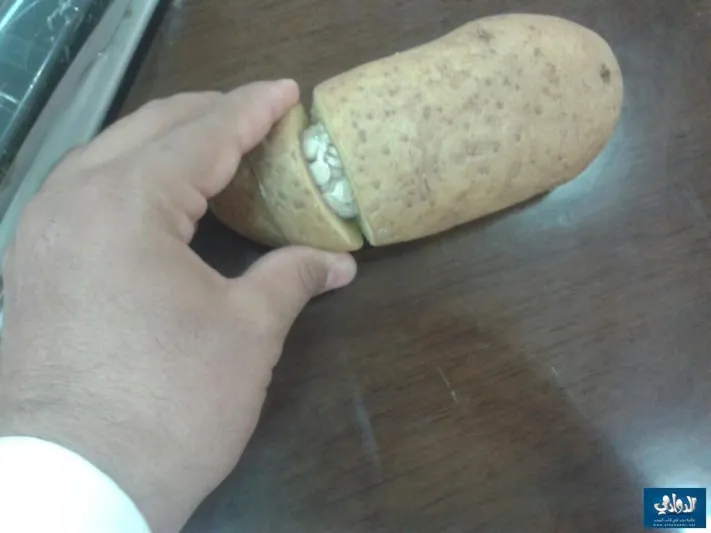 سعودي يعثر على 460 حبة كبتاجون داخل ثمرة بطاطس