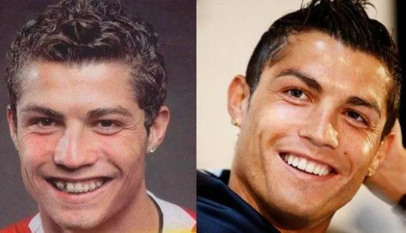 مشاهير العالم قبل وبعد