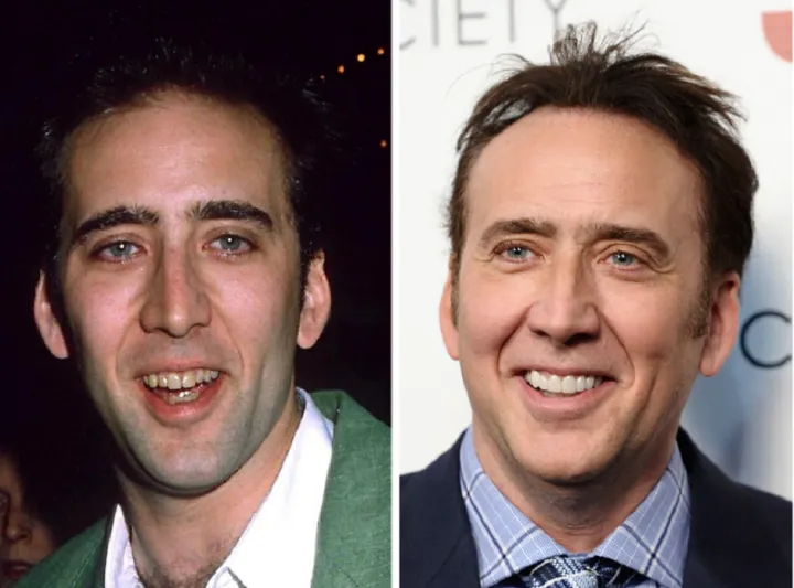 مشاهير العالم قبل وبعد