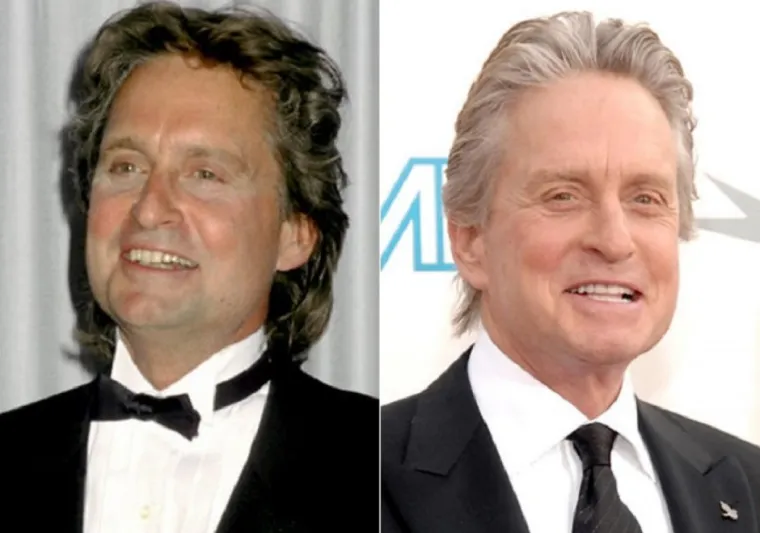 مشاهير العالم قبل وبعد