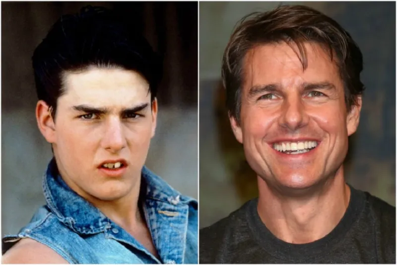 مشاهير العالم قبل وبعد