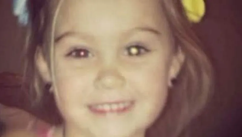 بالصورة: نشرت صورة ابنتها على "فيسبوك".. فاكتشفت أنها قد تصاب بالعمى