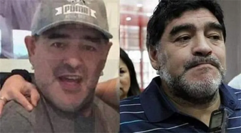 بالصور : مارادونا يجري عملية تجميل