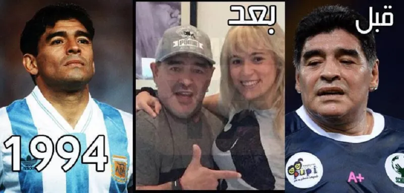 بالصور : مارادونا يجري عملية تجميل