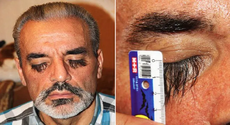 بالصور: صاحب أطول رموش في العالم