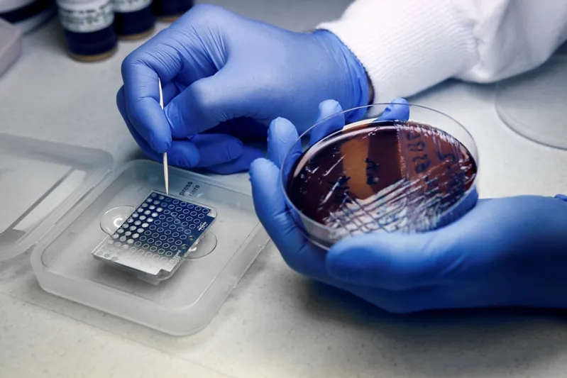 الباحث السعودي حسام الزواوي:  محارب "البكتيريا الخارقة"