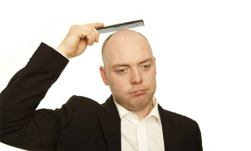 هل انت أصلع؟ .. ابتسم ..انت جذاب.