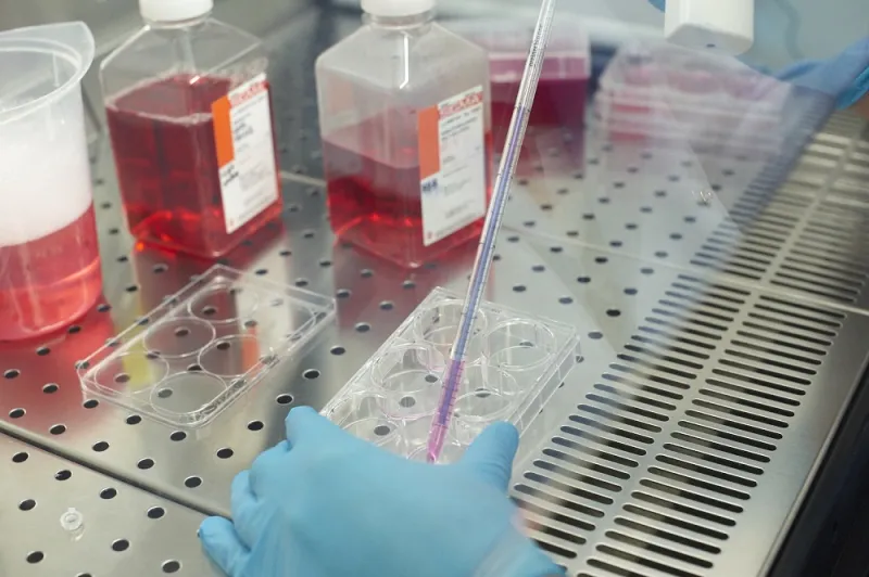 اكتشاف السبب الجيني وراء اضطراب العظام النادر