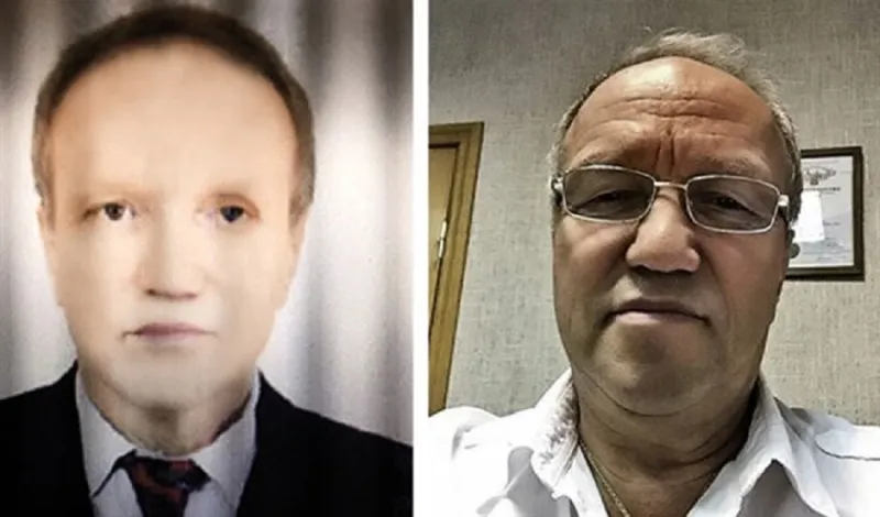 فاجأ الأطباء بتحوله الى اللون الأسود !!