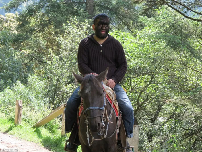 بالصور: عائلة الذئاب البشرية الأكثر شعرا حول العالم