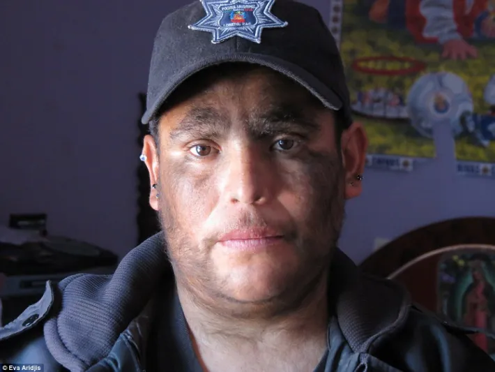 بالصور: عائلة الذئاب البشرية الأكثر شعرا حول العالم