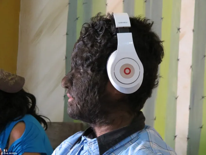 بالصور: عائلة الذئاب البشرية الأكثر شعرا حول العالم