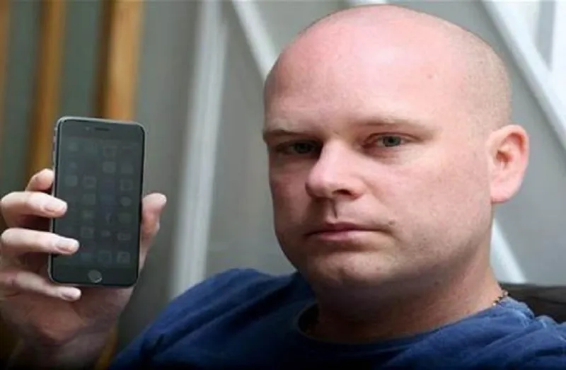 بريطاني يصاب بحساسية بعد شرائه هاتف "آي فون 6"