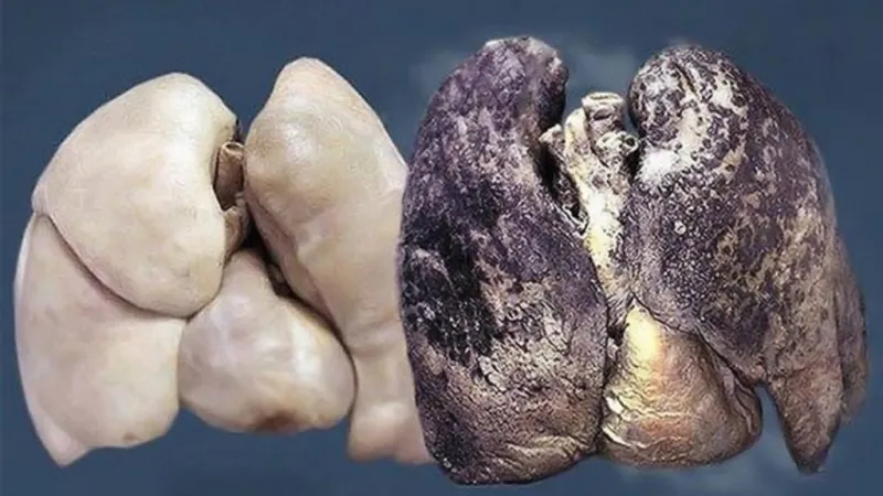 العلماء يكتشفون سر بقاء رئة بعض المدخنين سليمة