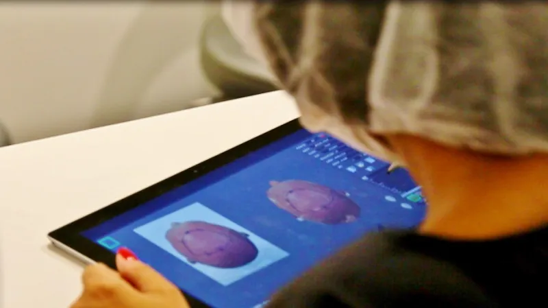 للتخلص من مشاكل الصلع: آرتاس ثورة عالمية في عالم زراعة الشعر