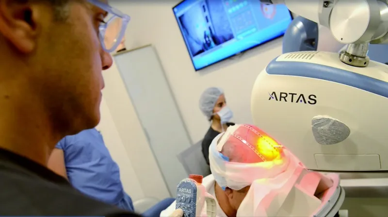 للتخلص من مشاكل الصلع: آرتاس ثورة عالمية في عالم زراعة الشعر