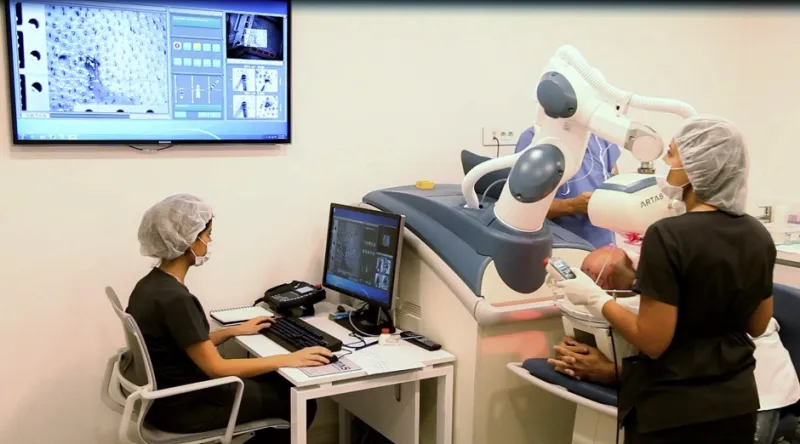 للتخلص من مشاكل الصلع: آرتاس ثورة عالمية في عالم زراعة الشعر