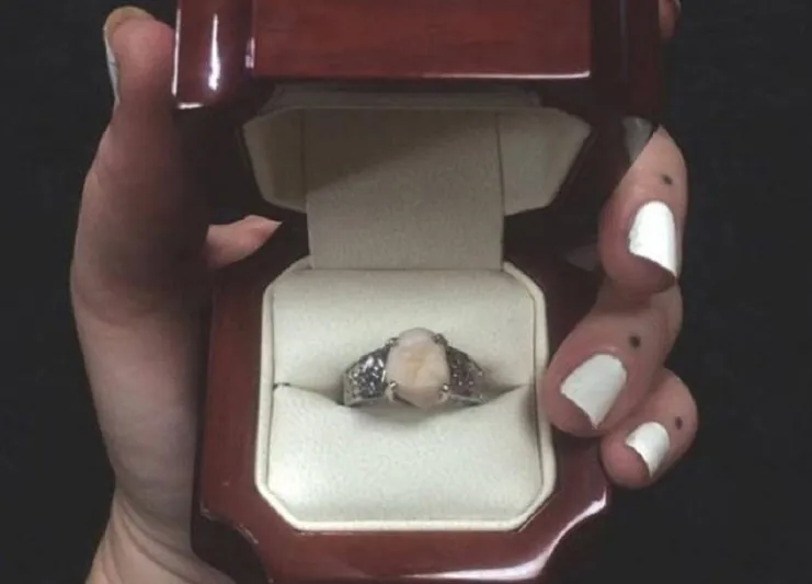 شاب يقدم لحبيبته أغرب خاتم أثناء طلب يدّها