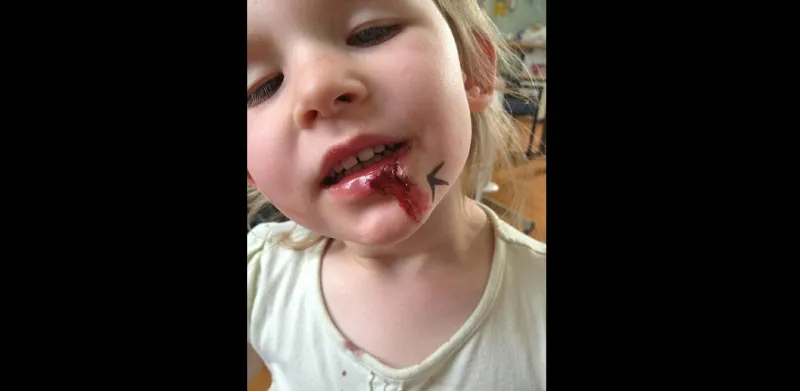 بالصور.. تعرف على الطفلة الخارقة 