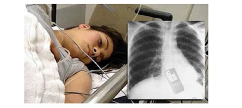 مراهقة تبتلع هاتفها لتخفي خيانتها.. ماذا حصل؟