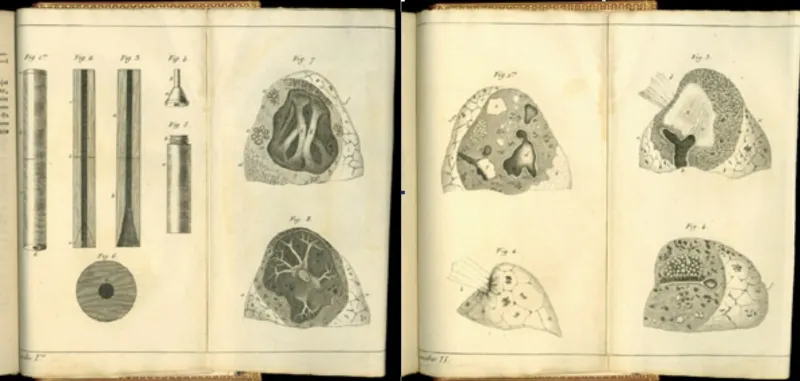 بالصور.. من هو رينيه ليناك الذي تحتفل Google  بذكراه 