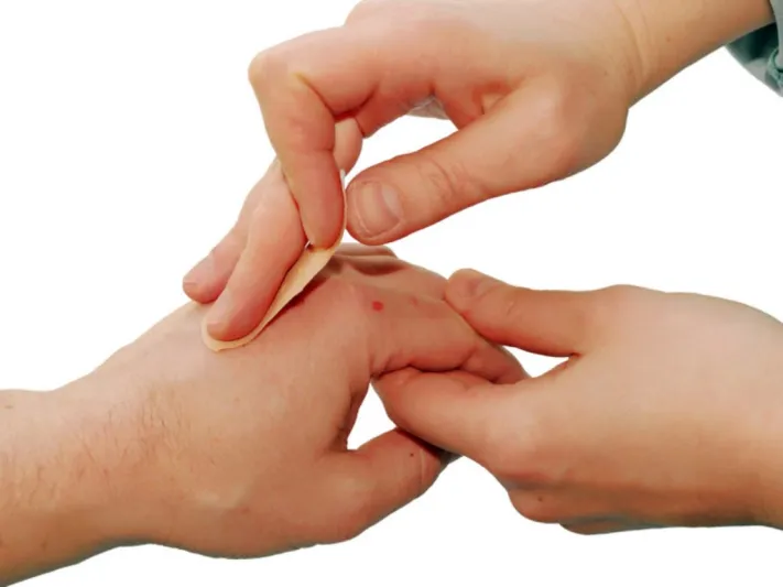 اكتشاف الجين المسؤول عن التآم الجروح