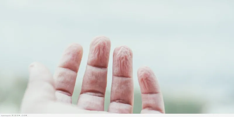 هذا هو سبب تجعد جلد أصابعنا في الماء