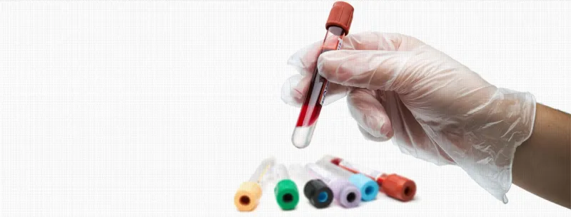 لائحة بأهم الفحوص الروتينية لصحة الرجل