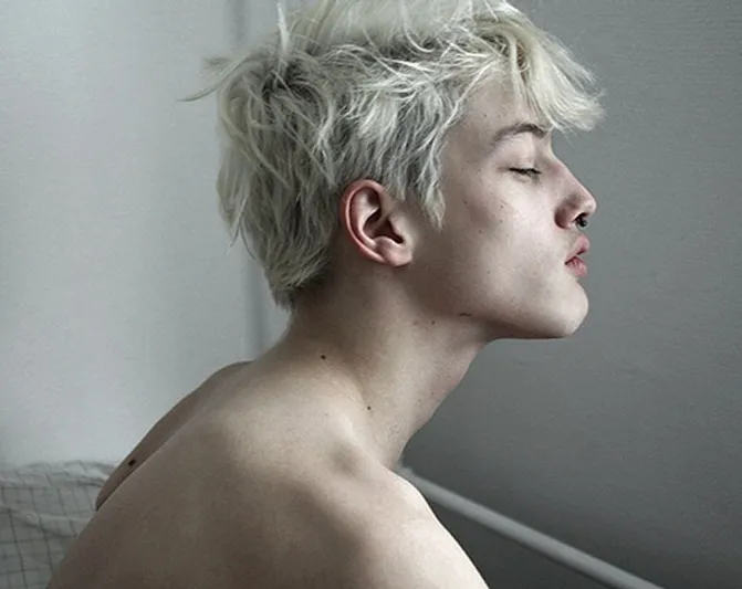 5 علامات بوجهك تشير لنقص فيتامينات محددة.. انتبه لها