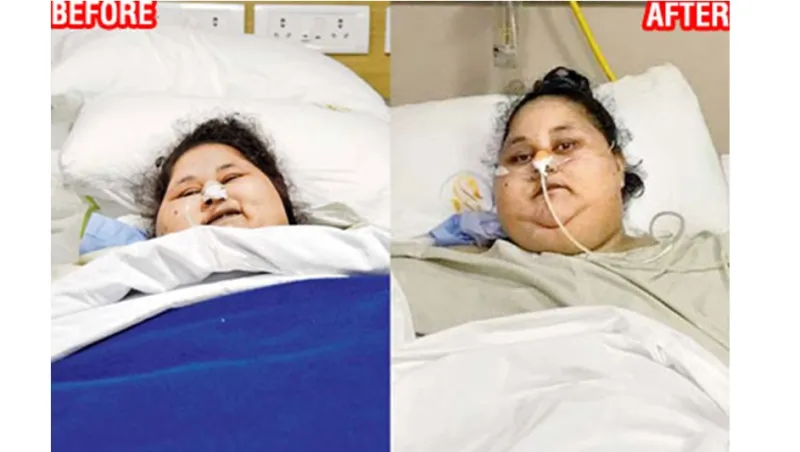 حل لغز المصرية إيمان عبد العاطي أسمن امرأة في العالم