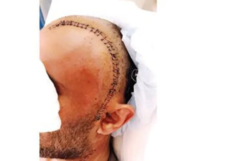 لجأ لمُعالج شعبي لإنهاء الصداع  فكانت النهاية مؤلمة