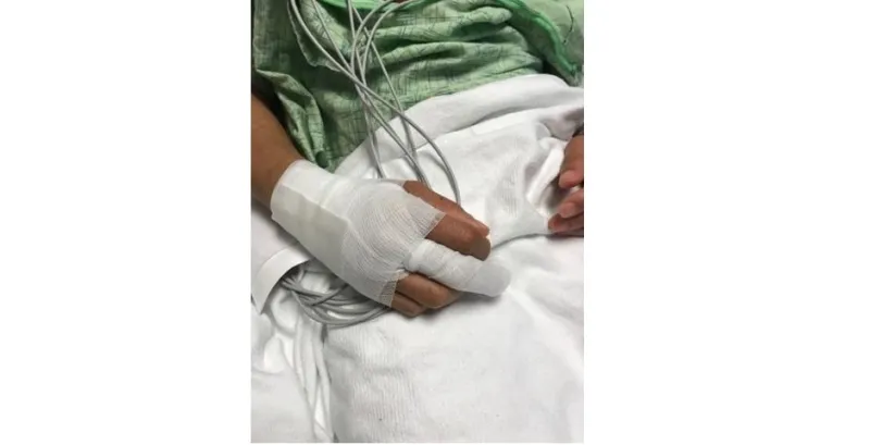 نام وبجواره شاحن الآيفون فقضى 3 أيام في المستشفى.. تعرف على قصته