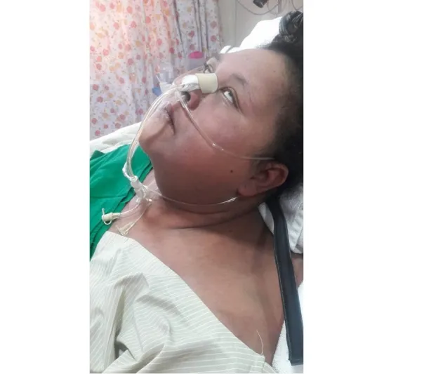 نهاية قاسية إصابة المصرية صاحبة النصف طن بالشلل