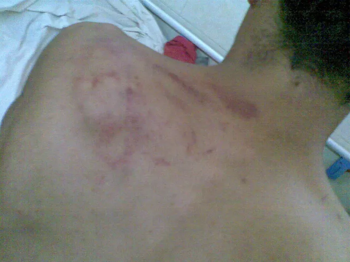 فيديو| عامل يقوم بتعذيب لأحد نزلاء مركز التأهيل الشامل في محافظة وادي الدواسر