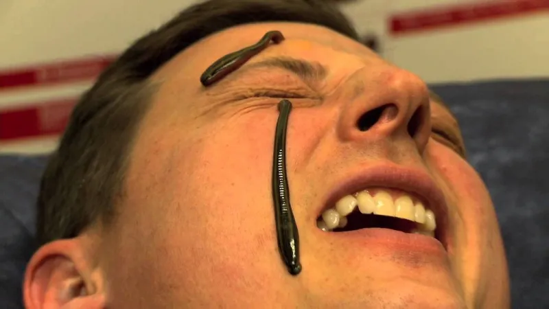 تعرف على أغرب الطرق العلاجية في التاريخ..منها ما يمارس حتى الان!