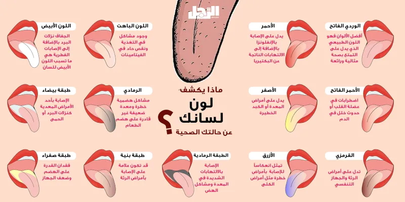 إنفوجراف| بحسب لونه.. هذا ما يخبرك به لسانك عن صحتك