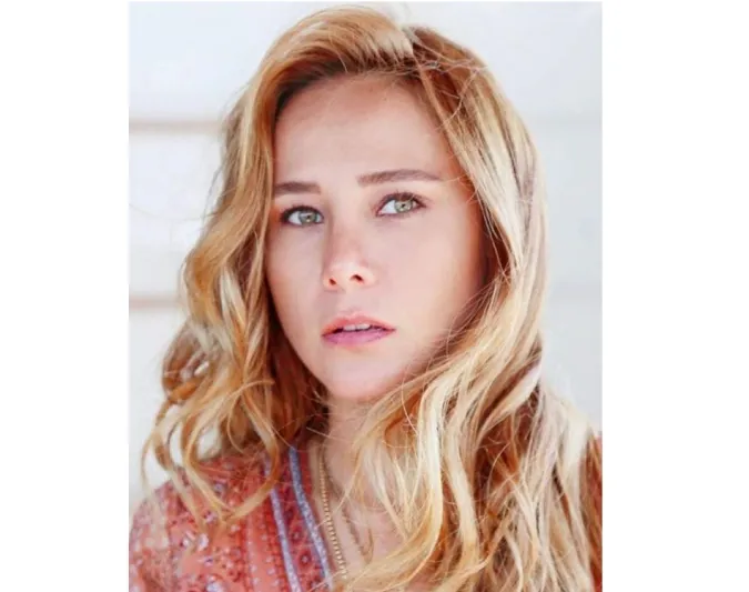 عمليات التجميل تصل الى طليقة مراد يلدريم فهل تغيّر شكلها كثيراً